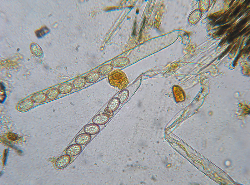 Scutellinia